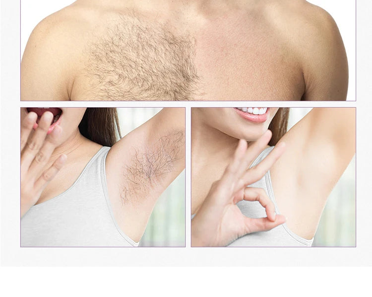 Depiladora IPL fastyle